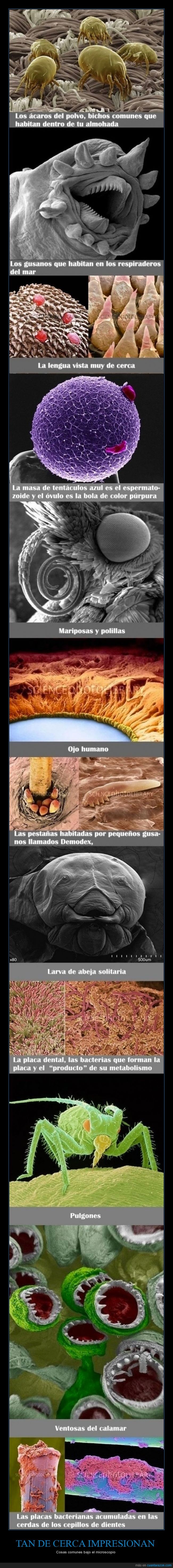 microscopio,Cepillo de dientes,bacterias,Ventosas del calamar,pulgones,La almohada,Los gusanos de los respiraderos hidrotermales,óvulo,espermatozoides,La lengua,ácaros,Mariposas y polillas,ojo humano,Las pestañas,Larva de abeja solitaria,La placa dental,sorprendente